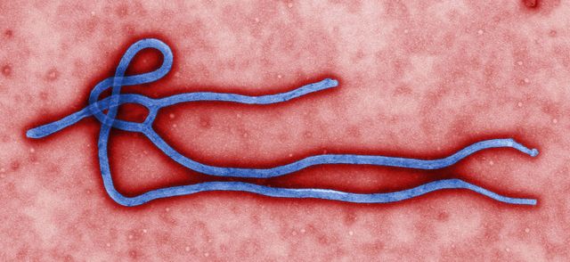Изображение вируса Эбола. Фото с сайта wikipedia.org